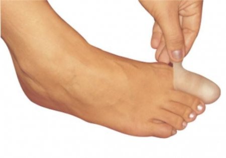 Protetor Para Unhas Encravadas Ortho Pauher Skingel