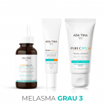 Tratamento Melasma Grau 3