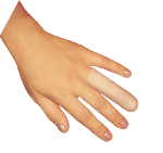 Dedeira Skingel sem Malha Ortho Pauher G SG 103